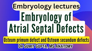 Atrial Septal Defects  Embryological basis [upl. by Sonitnatsnoc]