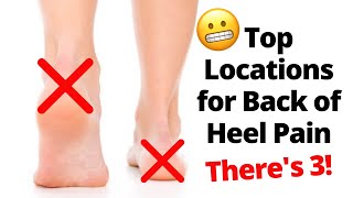 Back of The Heel Pain Locations [upl. by Eyar]