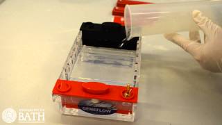 Agarose Gel Electrophoresis of DNA fragments amplified using PCR [upl. by Etep]