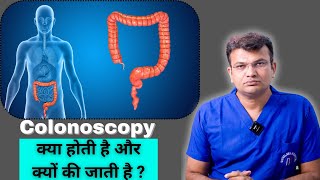 Colonoscopy क्या होती है और क्यों की जाती है   कोलोनोस्कोपी बड़ी आंत की जांच कैसे की जाती है [upl. by Eob82]