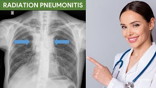 Radiation Pneumonitis [upl. by Dareg]