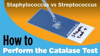 How to Perform the Catalase Test  Staphylococcus vs Streptococcus [upl. by Smiley]