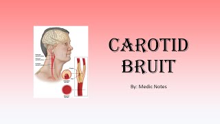 Carotid bruit  causes pathophysiology sign value [upl. by Cutcheon]