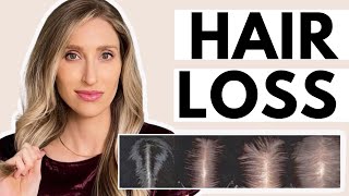 Hair Loss Dermatologist Shares What Causes it amp the Best Treatments Minoxidil amp More [upl. by Nahtaj]