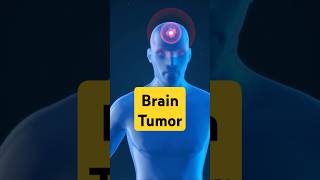 What is Brain Tumor brain tumor clot [upl. by Yevol]