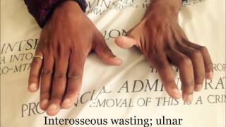 Hand Examination  Orthopaedic teaching video Cape Town [upl. by Eimmaj]