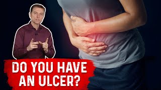 Understanding Ulcers How Do You Know If You Have One – Dr Berg [upl. by Murtha]