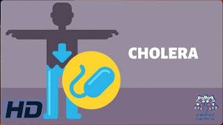 CHOLERA Everything You Need To Know [upl. by Enois206]