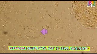 Entamoeba histolytica cyst in stool microscopy [upl. by Liza]