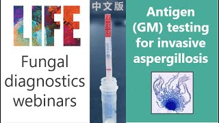 Aspergillus antigen galactomannan  fungal diagnostics webinar with QampA invasive aspergillosis [upl. by Yancey]