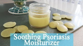 How To Make Soothing Psoriasis and Eczema Cream Naturally [upl. by Akcir]