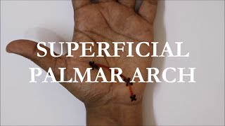 Surface marking of Superficial Palmar Arch [upl. by Forest]