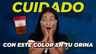 Color de la orina ¿qué dice sobre tu salud [upl. by June]