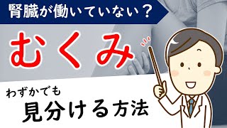 【1日1分】腎不全のサイン「むくみ」早く見つける方法は？【腎臓内科医が解説】 [upl. by Penhall]