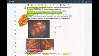 5MALROTATION ampSMA SYNDROME [upl. by Aroel654]