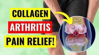 The Truth About Collagen for Arthritis Pain [upl. by Pruter537]