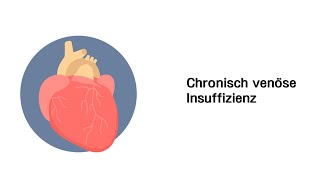 Chronisch venöse Insuffizienz CVI  Erkrankungen der Gefäße und des Kreislauf [upl. by Akemot833]