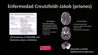 Radiología en 5 minutos Enfermedad Creutzfeldt Jakob Priones [upl. by Musser]