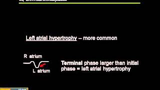 1215 Lead ECG Atrial Hypertrophy [upl. by Ecyt]