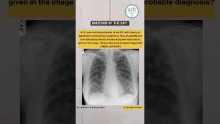 Options are  A Bronchogenic carcinoma B Asthma C Metastasis D Pneumoconiosis [upl. by Tra377]