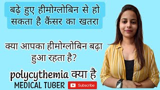 what is polycythemia and what is the symptoms polycythemia polycythemiavera highlights highrbc [upl. by Byler617]