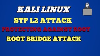 Kali Linux  STP L2 Attack and Protecting Against Root Bridge Attack [upl. by Aryc]