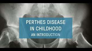 Perthes Disease in Childhood  An Introduction [upl. by Trudy]