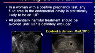 Part1 Sonography of the 1st Trimester Another Look Oksana H Baltarowich MD [upl. by Sedicla]