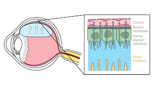 Mechanism of Retinal Reattachment Following Pneumatic Retinopexy [upl. by Mattland182]