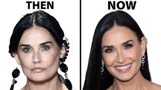 Demi Moores NEW FACE  Plastic Surgery Analysis [upl. by Seys619]