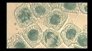 16 Skill Identifying stages of mitosis under a microscope and on a micrograph [upl. by Ylrebma923]