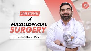 Case Studies of Maxillofacial Surgery  Best Plastic Surgeon in Gurgaon  SB Aesthetics [upl. by Simons]