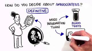 Prenatal Screening Options Amniocentesis [upl. by Mauro]