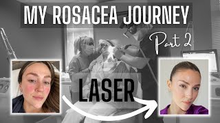 ROSACEA JOURNEY PART 2  VBEAM PERFECTA® LASER EXPERIENCE WITH DAILY PROGRESSION [upl. by Ilyk]