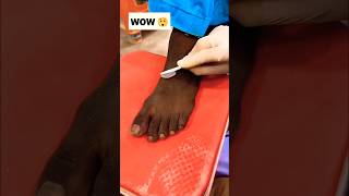 Permanent Feet Dirt amp Tanning Removal PackMost Easy Pedicure diy ytshorts shorts [upl. by Amadeus]