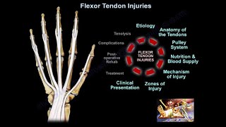 Flexor Tendon Injuries  Everything You Need To Know  Dr Nabil Ebraheim [upl. by Diandre287]