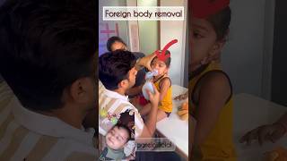 Foreign baby removal😂🤣 baby doctor family drimranpatel shorts shortsfeed short ytshorts [upl. by Bohs620]