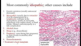 Lecture 7 Cardiomyopathy Cardiac tumors [upl. by Labotsirc]