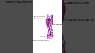 Common peroneal nerve lesion  features [upl. by Aciemaj]