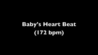 Fetal Heart Beat Audio 11 Weeks Pregnant [upl. by Noisla]