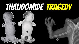 The Thalidomide Tragedy  The Rise and Fall of Thalidomide  No Bullsht  Episode 3 [upl. by Boonie]