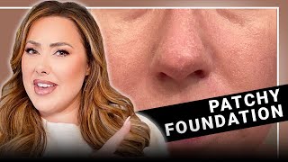 7 Reasons Why Your Foundation Looks PATCHY Tiktok didnt teach you these [upl. by Marline652]