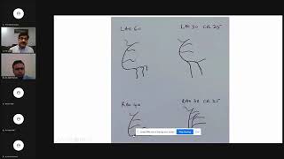 Coronary Angiography and coronary angiographic views India [upl. by Joashus]