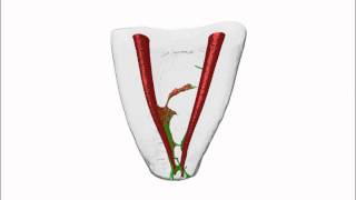 Root Canal Preparation Mandibular Molar by Dr Versiani amp Dr Keles [upl. by Lubbi298]