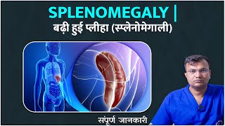 तिल्ली का बढ़ना Enlarged Spleen  किस वजह से होती है तिल्ली की बीमारी  जानिए लक्षण और उपचार [upl. by Wohlen792]