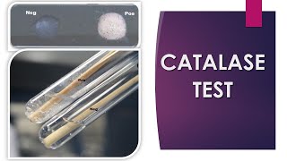 Catalase Test [upl. by Torry]