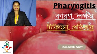 Pharyngitis In Bangla  Causes  Treatments  Home Remedies [upl. by Suivart]