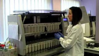 How Do You Process a Cytology Sample  Francesca Albertini [upl. by Anthe]