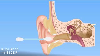 Forget QTips — Here’s How You Should Be Cleaning Your Ears [upl. by Grevera]