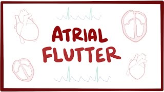 Atrial flutter  causes symptoms diagnosis treatment pathology [upl. by Aicelf]